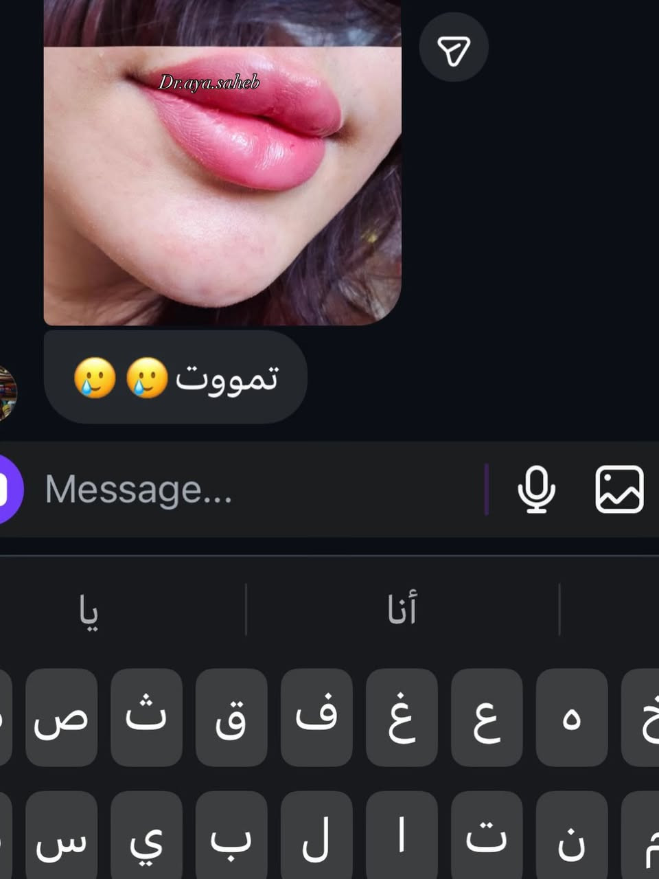 هالمرة البوست من تصوير مراجعاتي🫶🏻 رڤيو فلر الشفة لمختلف مراجعاتي حرفياً صورة احلى من صورة حرت شنو انزللكم💗💗
الديوانية 📍
للحجز/***********

