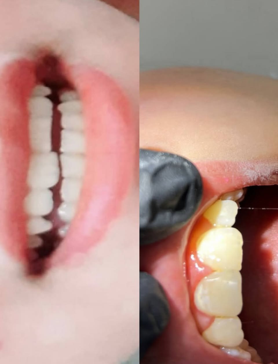 علاج اسنان مجاني في عيادات جامعة المنارة
للحجز الاتصال على الرقم 
 ‏‪0770 702 4073‬‏
