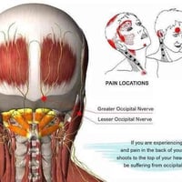 حجامة • لسع نحل • الرمادي شارع 60