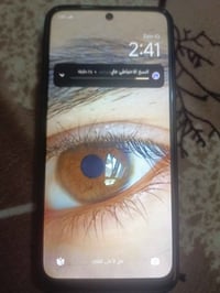 ريدمي نوت 11 • شاشة مكسورة • كركوك