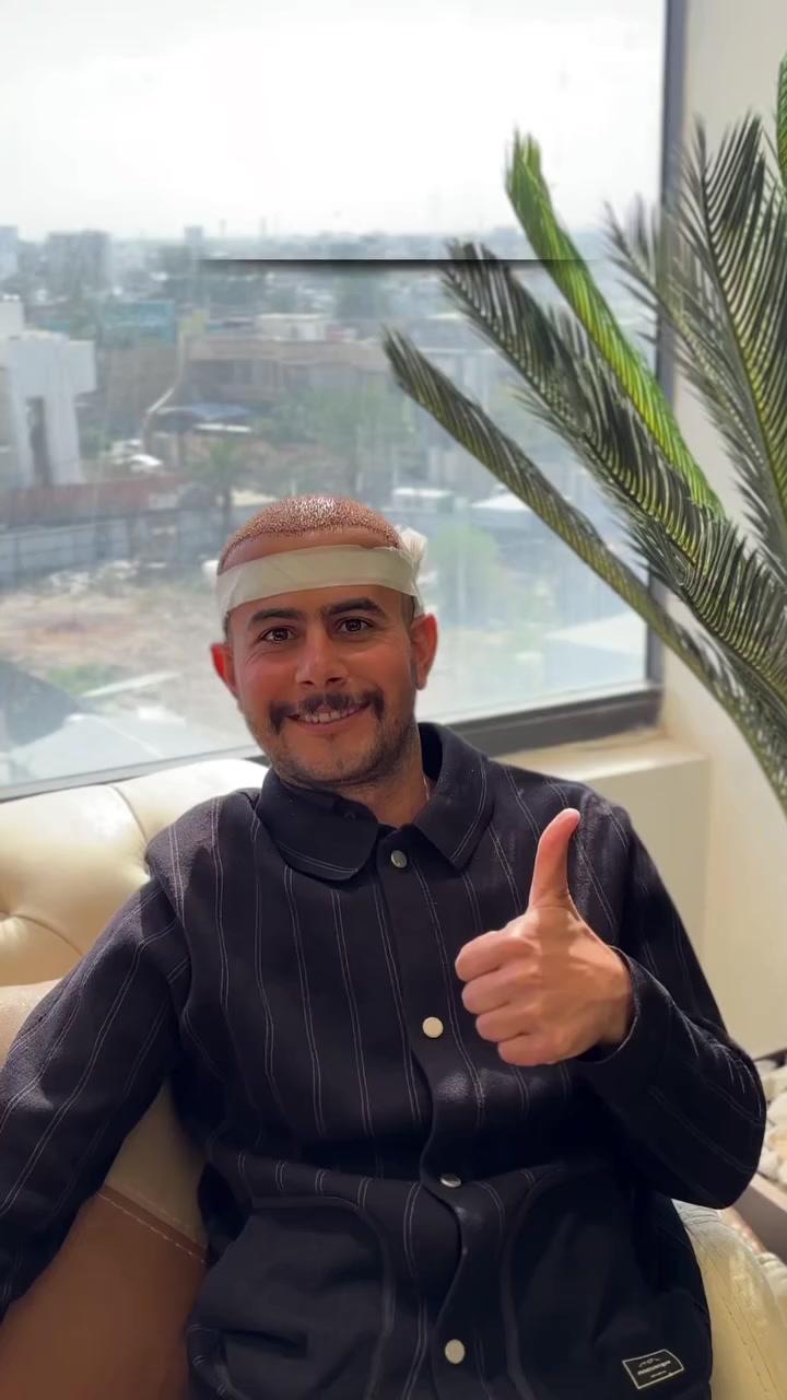 💥زراعة الشعر vip 
غيّر مظهرك… وخلي الثقة ترجع من جديد ✨
مجمع الكردي الطبي اختيارك الأفضل دائما 😍
زراعة الشعر صارت أسهل وأدق مع تقنياتنا الحديثة وخبرة كادرنا الطبي المتخصص، 
✔️ استشارة وفحص شامل
✔️ زراعة شعر بأحدث الأجهزة
✔️ متابعة مستمرة بعد العملية
✔️ نتائج تدوم وتبين طبيعي
💥لمعرفة العروض والاسعار التواصل واتساب💥
***********
#زراعة_الشعر #نتائج_مضمونة #قبل_وبعد #زراعة_الشعر_الحديثة #ثقة #مظهر_جديد #عيادة_زراعة_شعر
رابط التلي كرام 👇 شاهد جميع النتائج قبل وبعد زراعة الشعر 
https://t.me/salahwwww
