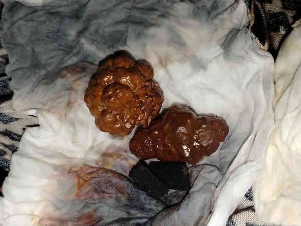 كلمن وسعره المحابس على 50 اي شي يعجبكم المراسله خاص او واتساب ***********
