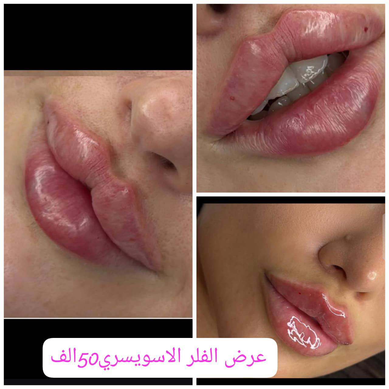 للحجز والاستفسار ***********
