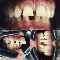 #مجمع ترف كلينك الطبي.

العنوان مدينة الصدر خلف سوق العورة 
قطاع ٧١ مقابل ملعب قطاع ٣٦
للحجز والاستفسار مراسلة الصفحة أو الاتصال على الأرقام التالية ☎️***********

خصومات ٤٠٪؜ لمدة ١٠ايام فقط 
وعروض
على جميع الحشوات 
والتركيبات 
والتغليف 
والزراعه
والتقويم
