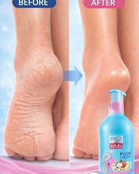 كريم القدم • تشققات الكعبين • ترطيب ٢٤ ساعة