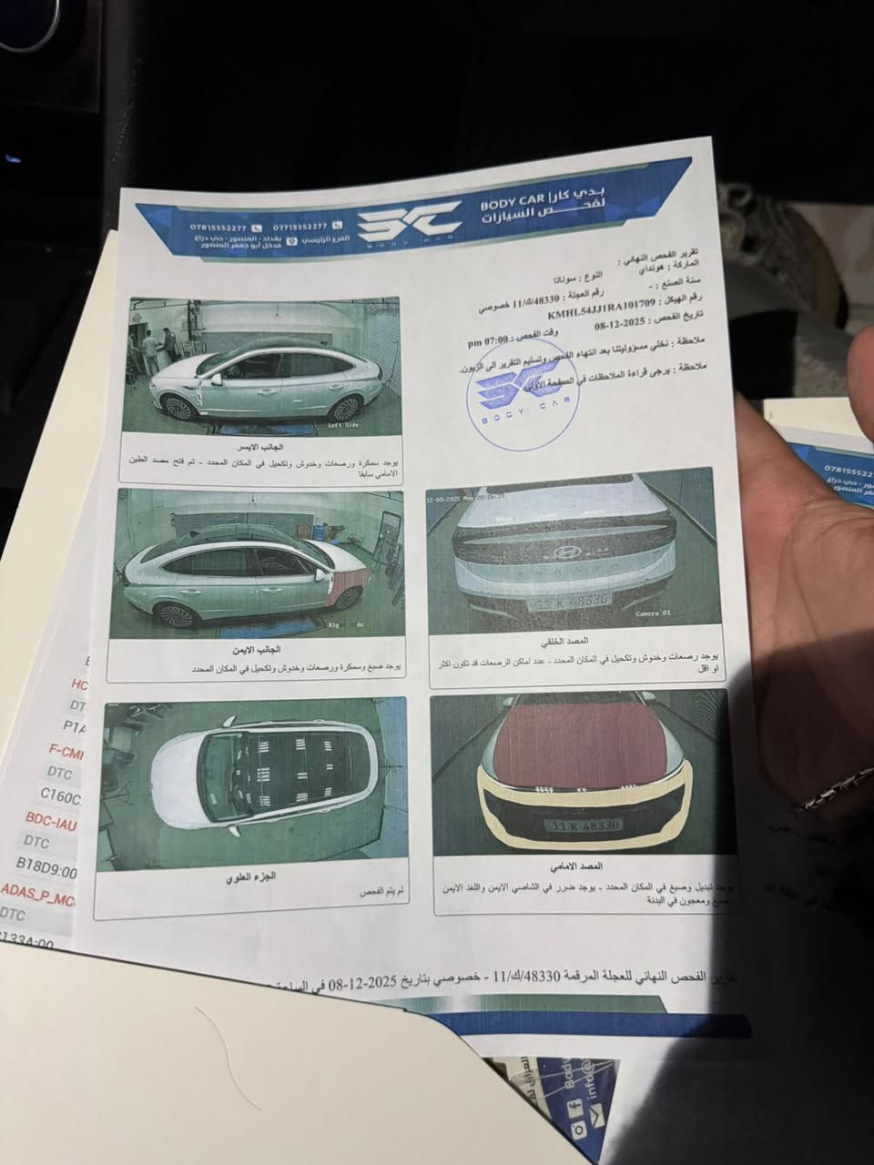 السلام عليكم ورحمة الله وبركاته
سوناتا هايبرد 2024 رقم بغداد تحويل ثاني يوم

المواصفات فول الفول 

بصمه أبواب 
بنراما فوول

بصمة تشغيل

اوتوبارك

ناقل حركه بالستيرن

تحديد مسار

سياقه ذاتيه

اناره داخليه متغيرة الألوان

كامرات محيطيه ٣٦٠ درجه

تقديم وترجيع بالريمونت 

تشغيل عن بعد 

صندوق كهرباء 

الممشى 7000

وبعد هواي مواصفات مو ذاكرينها

صور الحادث مرفقه بالمنشور  وسونار هم منشور 

السعر 210 وبي مجال بسيط اخوان كلشي موضح بالمنشور وسياره بدون نقص برغي جاهزه للاخير👍🏻

*********** واتساب ايضا موجود
