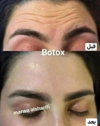 تتواجد اليوم داخل المركز       مروة الشريفي  🌼عرض خاص ‎مِہטּ مركز 🌼 تك...