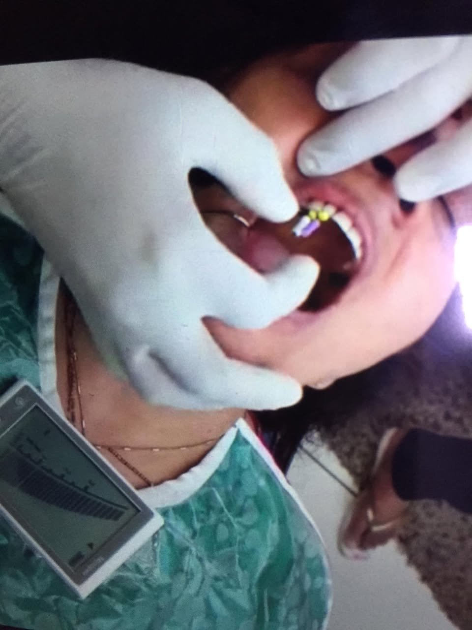 جهاز يخص الاسنان


**إذا كنت صاحب هذا الإعلان وتريد حذفه لأي سبب، رجاءا أرسل رسالة إلى الدعم الفني**