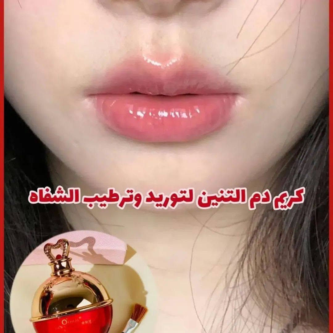 كريم دم التنين الاصلي 💋💋
كريم ماسك دم التنين ♥️♥️
مرطب ومورد مغذي شفايف يملئ الخطوط ويغذي الشفاه الجافة ويرطبها 
فوائده. 
🌸يورد الشفه 
🌸يمنع تكسر الشفه
🌸يزيل خطوط الشفه 
🌸يغذي ويرطب الشفة 
🌸يمنع ويعالج التشققات 

‎🌸 مورد ومرطب شفة مخصص لتغذيه الشفتين يرطبها ويعيد حيويتها وتوريدها 

🌸 كريم يمنع التشققات و تكسر الشفه و يخفف الخطوط الخفيفة
‎المرطب غني بفيتامين سي ومضادات الاكسده الي تنطي  تغذيه وعنايه وتعيد لون الشفه الجميل 

🌸 بلاضافه الى فوائد فيتامينات الفواكه المضافة اليه الي حينطي تغذيه مضاعفة و طعم لذيذ
#الاصلي #الكوري
 للحجز والاستفسار مراسلتنا على الخاص 
#مورد_شفايف 
#مرطب_شفايف


**إذا كنت صاحب هذا الإعلان وتريد حذفه لأي سبب، رجاءا أرسل رسالة إلى الدعم الفني**