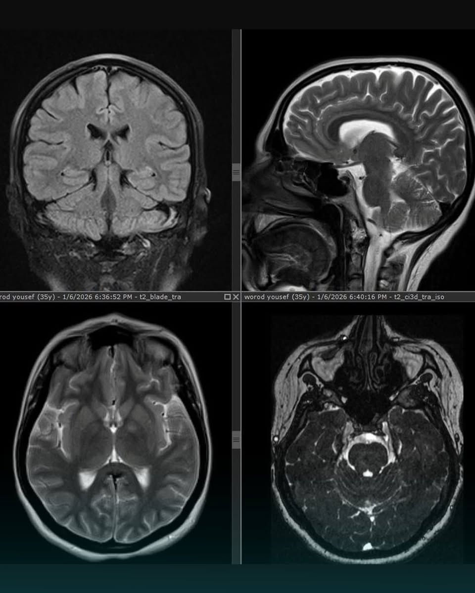 يتـــــــواجد غدا
وكل اثنين وخميس 
الدكتور مصطفى حميد مجيد
اخصائي طب الدماغ والاعصاب في مجمع الكندي 
شارع الاطباء الفرع الثاني 
للحجز ***********
