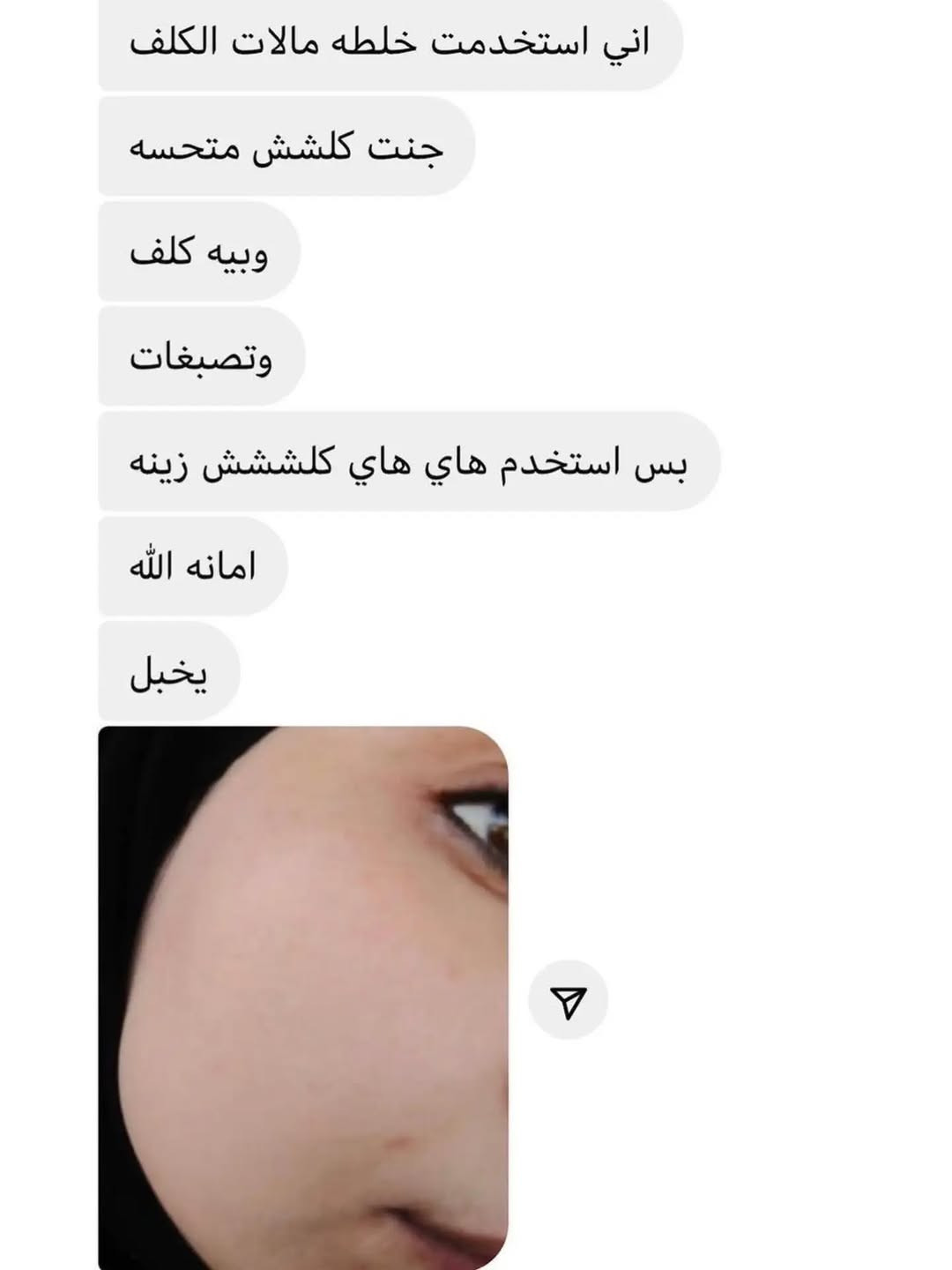 منو بعدها ماجربت خلطتي 
الوجة ثلج خلال 8 أيام 
كلف ماكو نهائيآ ومن تنترك مراح تأثر على الوجة 

اول سبوع تتخلى يومية 
ثاني اسبوع تتخلى بين يوم ويوم 
وثالث اسبوع تتخلى كل 3 ايام 
النتائج راح تبين أول 5 أيام 
الخلطة وحدها 15 مع الصابونه 20 
للطلب مراسلة الصفحة


**إذا كنت صاحب هذا الإعلان وتريد حذفه لأي سبب، رجاءا أرسل رسالة إلى الدعم الفني**