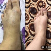 توصيل مجاني • مقشر جسم • عرض أسبوع