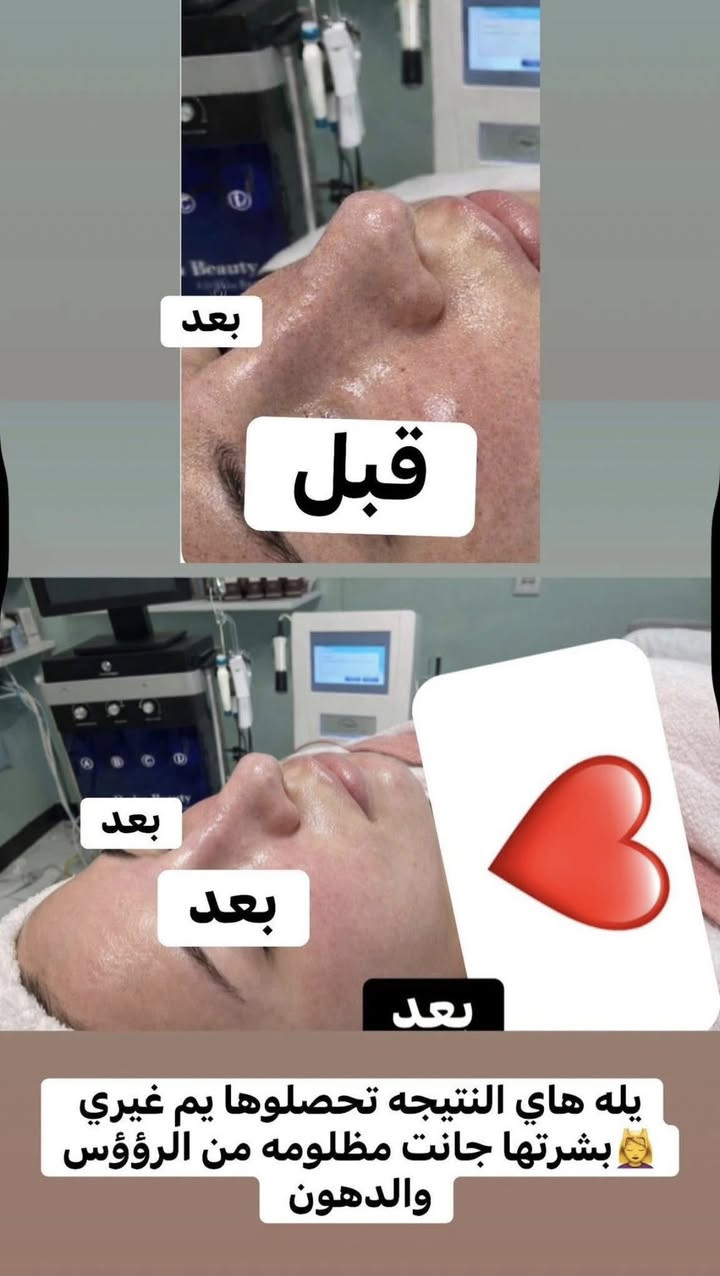 العرووووض بلصور اقوى عرض نزلته شنو منتضرين متحجزون لاتحصرون نفسكم اخر 3ايام حبابين 🫠♥️❌♥️

بوست المسابقه

🥰☘️🌸🎁وعدتكم بليل تنزل وهاي نزلتها

أفوز بااكثر انسانه توصلها مدح بعد الجلسه مالتي انزلو وشاهدو الرسايل وربي يشهد عليه كل الرسايل حقيقيه من زبائني جلسه التنضيف يمي غير غير والي مجربين اكتبو تجربتكم 

هلمره حبيت افرح وحده منكم بلعيد راح اعلن عن الفائز 
شروط المسابقه. اكثر تعليق ومشاركه وتآكات وتعليق الي مجرب يذكر تجربته ظروري واهم شي المشاركات بلكروبات وراح أفوز وحده بيكم🌝👩‍❤️‍👩@إشارة

بنات لتنويه من ترفعون المنشور بتعليقاتكم الي تريد تربح بلمسابقه ترد على تعليقها وتصعد يعني التعليق خلي بلرد


**إذا كنت صاحب هذا الإعلان وتريد حذفه لأي سبب، رجاءا أرسل رسالة إلى الدعم الفني**