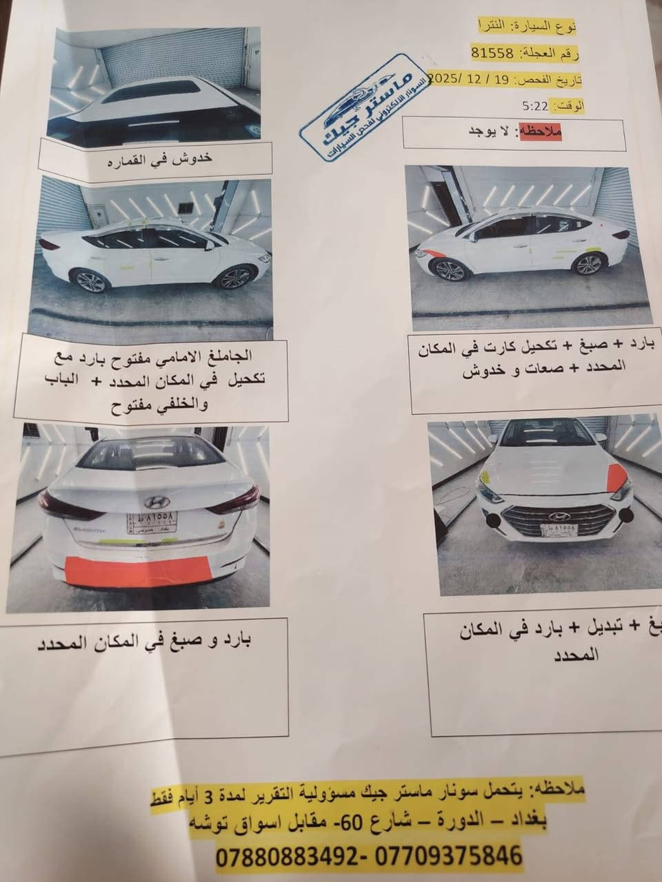النترا موديل 2018 خليجي رقم بغداد إنكليزي باسمي و التفاصيل داخل السونار
السعر 145 وبيها مجال 
الرقم ***********
كربلاء الحسينيه
