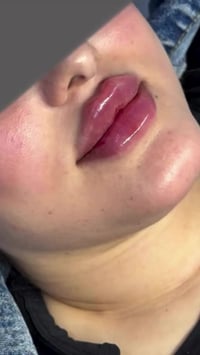 فلر • كوري • ٢ سي