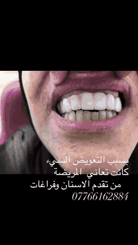 مع بداية العام الجديد عروض جديدة نستقبلكم لحل جميع مشاكل الاسنان ولابت...