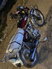 مراوس • نضافه • كدام العين