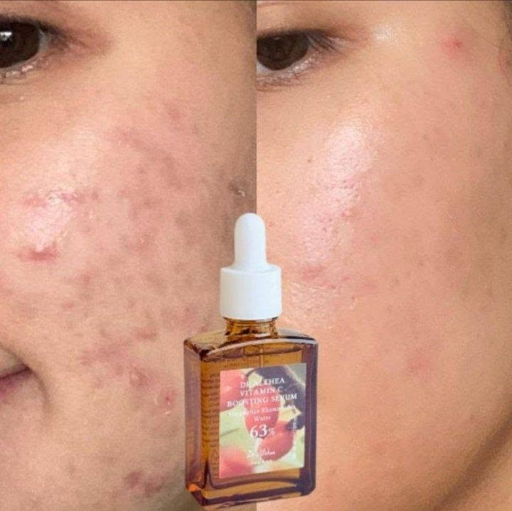 ترند جديد وصل ♥️♥️♥️
Medicube COLLAGEN NIGHT

القناع الليلي بالكولاجين

WRAPPING MASK

ماسك ليلي غني بالكولاجين يعزز مرونة البشرة ويرطبها بفعالية، ليمنحك إشراقة ونضارة صحية

يوفر عناية مكثفة بفضل طبقة الكولاجين التي تحافظ على الرطوبة

والمغذيات في أعماق البشرة أثناء النوم

يساعد في تحسين ملمس البشرة وإصلاح حالتها في غضون أسبوعين مختبر سريريًا وآمن لكل أنواع البشرة وحتى للبشرة   الحساسة
متوفر المنتج حصرياً الاصلي مع  ضمان الباركود 

#توصيل_كافة_المحافظات


**إذا كنت صاحب هذا الإعلان وتريد حذفه لأي سبب، رجاءا أرسل رسالة إلى الدعم الفني**