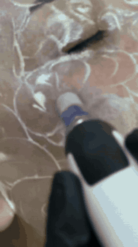 ميزووايت #تفتيح وتبيض البشرة  ***********
