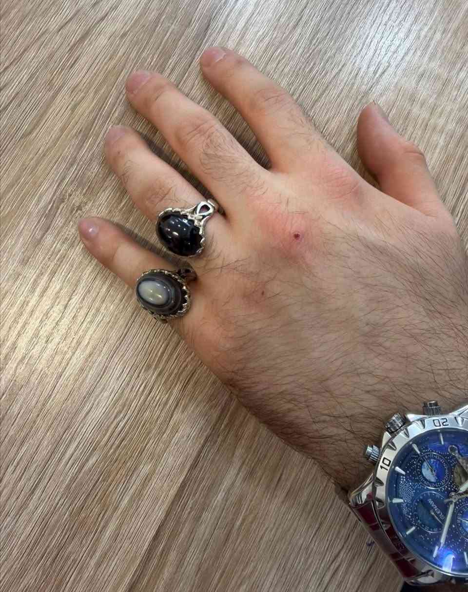 للبيع  محابس  قديمات  75الف  وبي  مجال 
 عقيق  عين سليماني  وعقيق  اسود 
 فضه عراقي


**إذا كنت صاحب هذا الإعلان وتريد حذفه لأي سبب، رجاءا أرسل رسالة إلى الدعم الفني**