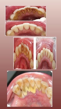 طالبة طب اسنان • علاج مجاني • الرمادي جامعة المعارف