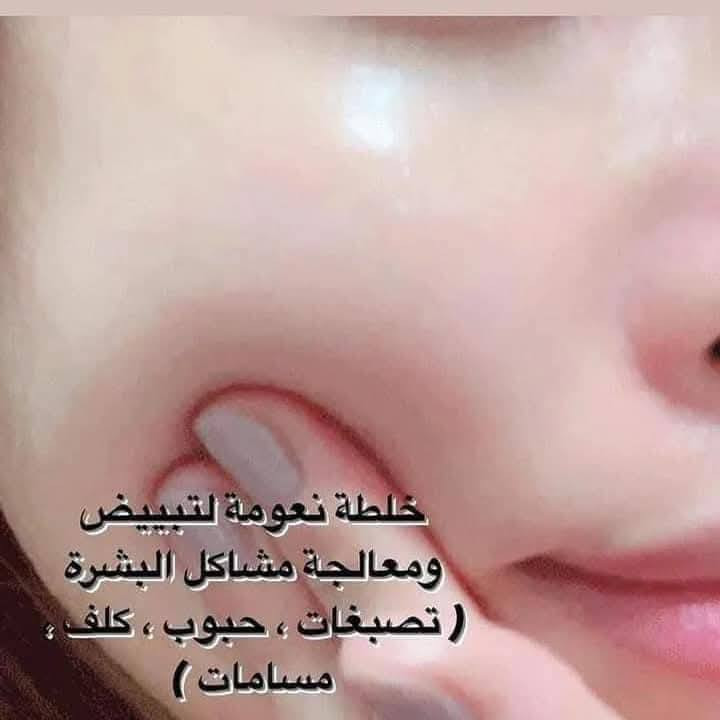 # تعالوا بسرعه وين اللي يردون بشرتهم مثل الكزاز  صح اكو اهواي خلطات وبيجات تنشر
بس مو مثل #خلطتي  ...الله شاهد كل زبائني الجربوهه كالولي وين جنتي من زمان   شوفوا الاستوري والصفحه وتجارب الزبائن نتيجه خلال اسبوع  فقط....خلطة الله شاهد نتائجه تجنن عن تجارب زبائنه 
مميزات وفوائد الخلطة
1.تبيض الوجه وازالة التصبغات
2.اخفاء الهالات السوداء حول العينين
3 .الرؤوس السوداء و الكلف والنمش
4. شد البشره و القضاء على التجاعيد
5 تعالج حب الشباب 
((للرجال والنساء))
لاتوجد فيه اي ماده كيمياوية
موادهه امريكيه🇱🇷 اصليه مو كريمات والتوب شيلي وهل السوالف القديمه
اكو مسمنه واكو بدون مسمن حسب رغبتكم💋🏃‍♂️🏃‍♂️
ملاحظه مهمه كل التجارب المنشورات بالصفحه الله شاهد تجارب حقيقيه والزبائن يمدحون بيه شوفوا الاستوري ☝️☝️
للحجز يرجى مراسلتنا على الخاص🏃‍♂️توجد خدمة توصيل لجميع المحافظات


**إذا كنت صاحب هذا الإعلان وتريد حذفه لأي سبب، رجاءا أرسل رسالة إلى الدعم الفني**
