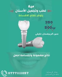 �✨ زراعة الأسنان مع ميلا  تريد ترجع ابتسامتك الطبيعية؟ زراعة الأسنان ص...