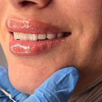 ابتسامتك الجميلة تبدأ من هنا، لأننا نهتم بأدق التفاصيل  متواجدين لخدمت...