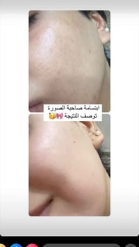 ❄️ احد اهم افضل المنتجات لتبييض البشرة ❄️ . 🟢كريم فيفيان مصنوع من 14 م...