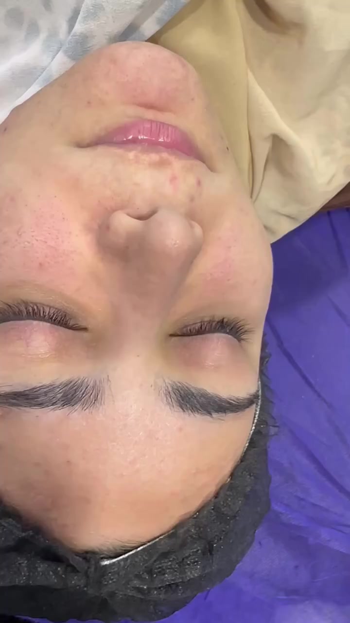 داشكاندانى 🔥هايدارفيشل vip💎 تنها به 20هه زار  له سه نته رى ليندا بيوتي به پى حجز ***********📞
