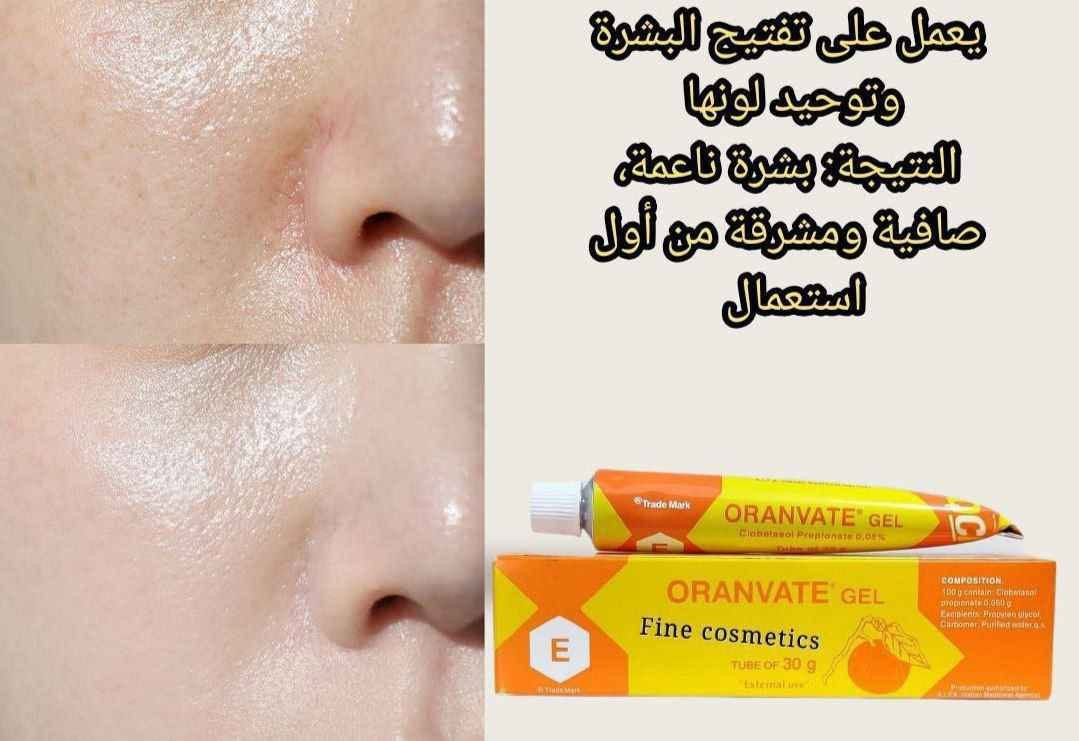 توفرت عصارة جل موفيت MOVATE.🍊 ORANVATE GEL الإيطالي 🇮🇹 

👌🏻 يعمل على تفتيح البقع الداكنه
👌🏻 وعلاج تصبغات البشره والوجه و الرقبة و الركب و المرافق و اصابع اليدين و 
👌🏻الاماكن الحساسة ويعمل على منع تجمع الميلانين بالجسم المسؤول عن التصبغات وعلاج اثار الحبوب و تهيج البشرة الحساسة

✅ يساعد الجل على معالجة تفاوت لون البشرة والآثار الناتجة عن التعرض للشمس.
✔️ يساهم في تقشير الطبقة السطحية من الجلد، مما يعزز التخلص من خلايا الجلد الميتة والبقع السوداء.
✔️ يساعد على استعادة نعومة البشرة ونضارتها، مما يمنحها مظهرًا أكثر صحة وإشراقًا.
✔️ بفضل تركيبته الهلامية (الجل)، يمتص المنتج بسرعة دون ترك بقايا دهنية، مما يجعله مناسبًا للاستخدام خلال النهار.
✔️مناسب للبشرة الدهنية والمعرضة لحب الشباب تركيبته الخفيفة لا تسد المسام، مما يجعله خيارًا أفضل لأنواع البشرة الدهنية.
✔️ يعمل على منع تكوين الميلانين، وهو الصبغة المسؤولة عن ظهور البقع الداكنة، مما يساعد في علاج التصبغات.
✔️ فعال بشكل خاص في تفتيح المناطق ذات الجلد السميك أو البقع العنيدة مثل مفاصل الأصابع، الأكواع، الركب، وتحت الإبطين .

 المنشأ..  إيطالي🇮🇹💯

 توصيل لجميع محافظات العراق بغداد, العراق


**إذا كنت صاحب هذا الإعلان وتريد حذفه لأي سبب، رجاءا أرسل رسالة إلى الدعم الفني**