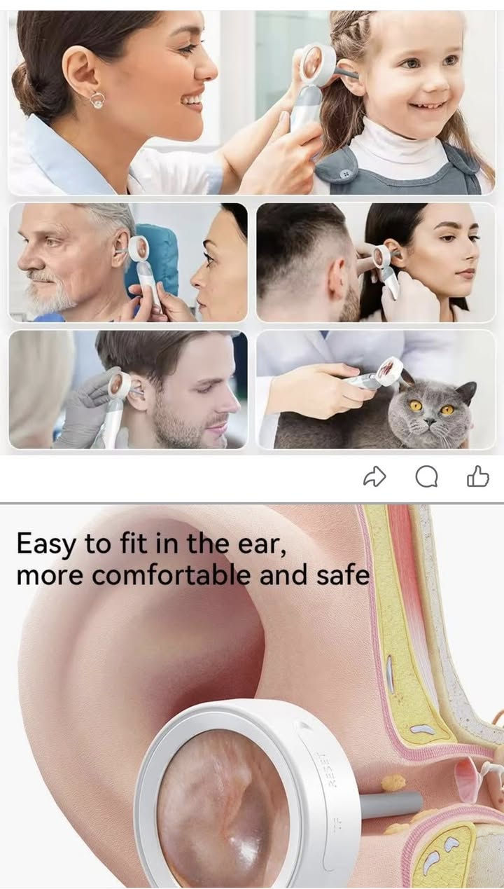 كاميرا اذن وانف سمارت مع شاشه السعر ١٥


**إذا كنت صاحب هذا الإعلان وتريد حذفه لأي سبب، رجاءا أرسل رسالة إلى الدعم الفني**