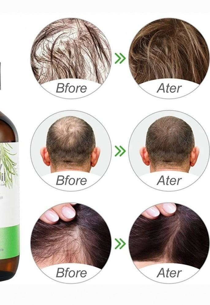 هذا هو قطرات اكليل الجبل 
وهو منتج عشبي مخصص للاستخدام الموضعي.الاستخدامات الرئيسية: يُستخدم لتقوية بصيلات الشعر والحواجب، والمساعدة في منع تساقط الشعر.الفوائد الإضافية: قد يساعد في علاج قشرة الرأس ونمو  شعر 
بفضل احتوائه على مستخلصات عشبية 
طريقة الاستخدام: يوضع موضعياً على فروة الرأس أو الحاجبين، 

 
إليس إكليل  الجبل 🥰
#يساعد_على_تقوية_نمو_الشعر_والحواجب

تحذيرات:
يُحفظ مغلقًا بإحكام بعد الاستخدام.
يحفظ بعيدًا عن متناول الأطفال.
يحفظ بعيدًا عن الضوء المباشر ويُخزن في مكان تتراوح درجة حرارته بين 15 و30 درجة مئوية.
لمزيد من المعلومات، راجع النشرة الداخلية واحتفظ بها حتى نهاية الاستخدام.
مُستخلص من:
لإكليل الجبل، 
Ellis Laklir Al Rosmarin 🥰
#Helps_strengthen_hair_and_eyebrow_growth

Warnings:
Keep tightly closed after use.
Keep out of reach of children.
Protect from direct light and store between 15°C and 30°C.
For more information, see the enclosed leaflet and keep it until the end of use.
Extracted from:
Rosemary
لازوردي_البابلي العنـوان #السماوة على كورنيش الحجز والاستفسار راسلنا على واتساب ***********
