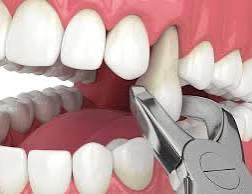 تعلن لكم عيادات جامعة الكفيل عن خدماتها
1_ قلع الأسنان والجذور المتبقية (مجاناً )

2_طقم أسنان متحرك 

للحجز ارسل تم او تواصل مع الرقم ***********
