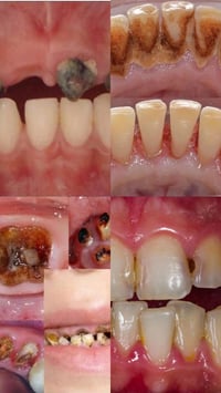 خدمات مجانية • عيادة أسنان • جامعة اهل البيت