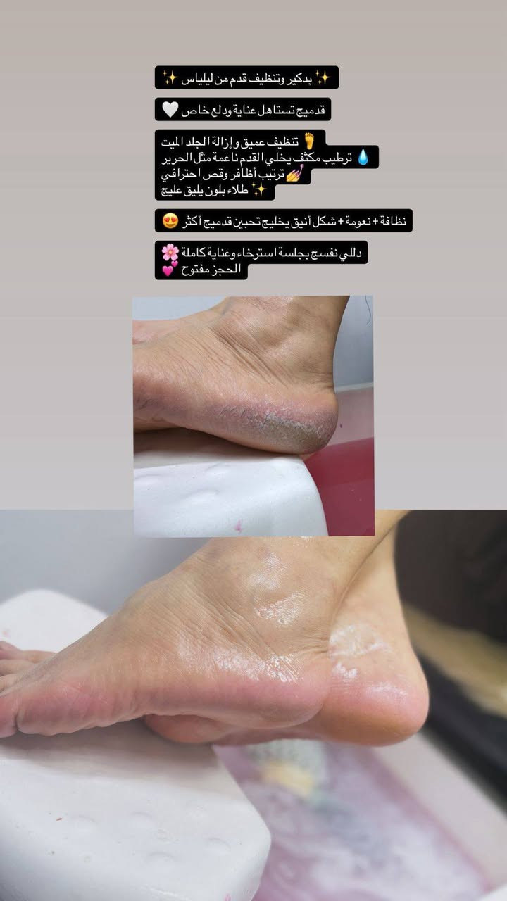 عروض سنتر وصالون ليلياس للتجميل العرائس♥️ 
اظهري جمالك بلمساتنا الفنية وكوني مميزة باختيارك النا 💥تحت أيدي طاقم مختصين بالجمال سنتروصالون ليلياس للتجميل العرائس
🩷🩷🩷🩷
متواجدين من 9صباحا الي 7 مساء 

حجز والاستفسار ***********

العنوان بابل حي طياره مقابل مول الحسن 🩷
