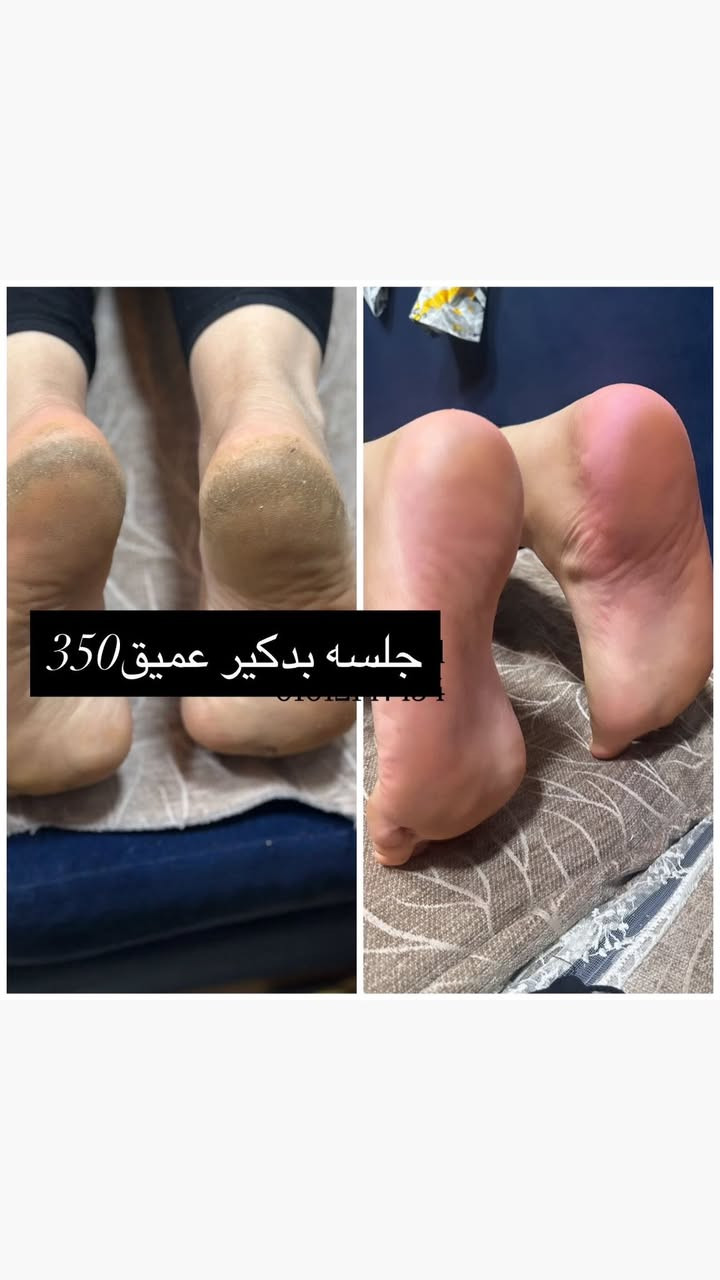 العروض موجوده من النهارده تعالو ف اي وقت اعملوها♥️♥️
للتواصل @ [153***********65:13708:010 12147454]
