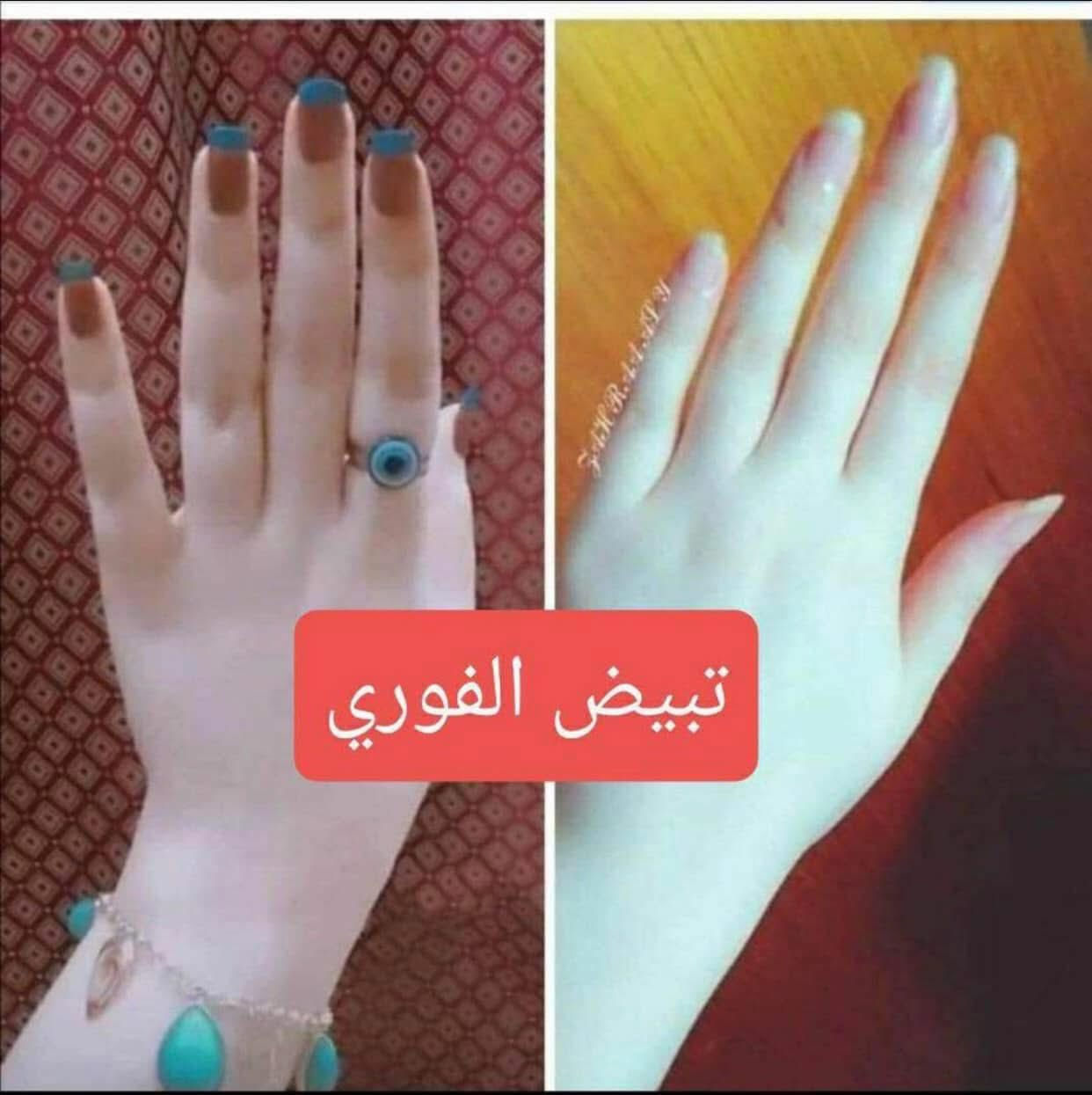 #عرض_لمدة_أسبوع توصيل مجاني لكل المحافظات 🚚  فقط رشي على الجسم وخليه دقيقة وبعدها افركي وشوفي شكد بشرتچ تصير أنعم وأحلى بالملمس 😍  يساعد يزيل الجلد الميت ويخلّي البشرة تبين أصفى وأنعم ممتاز للركب، الأكواع، القدمين، وكل الجسم ✨  يُستخدم 2–3 مرات بالأسبوع ضمن روتين العناية 🎀  اكتبي (تم) ونرسل لج التفاصيل 💌


**إذا كنت صاحب هذا الإعلان وتريد حذفه لأي سبب، رجاءا أرسل رسالة إلى الدعم الفني**