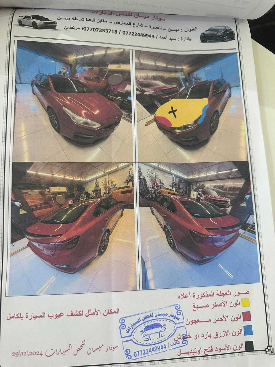 فورتي ٢٠٢١
رقم مسيان معوقين
جيتي فول مواصفات
سعر ١٤٥
***********
