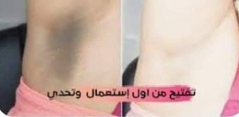 كريم مبيض فعال لجميع الجسم 🥰
شوف الفرق من أول أسبوع 😍😍
السعر العلبه ١٥🤩🤩🤩🤩
التوصيل مجاني للجميع المحافظات  القضية 🚗🚗🚗


**إذا كنت صاحب هذا الإعلان وتريد حذفه لأي سبب، رجاءا أرسل رسالة إلى الدعم الفني**