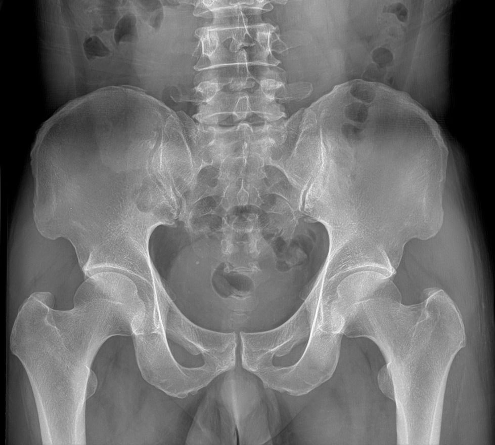 🏥✨ مكتب الجوهرة للأجهزة الطبية ✨🏥

📢 متوفر لدينا الآن

🔹 مستقبل الأشعة الرقمي (DR Detector)
🔹 نوع SHOW IMAGE
🔹 أجهزة جديدة بالكامل (غير مستعملة)

⭐ المواصفات والمزايا:
✅ Wireless – اتصال لاسلكي كامل
✅ AED (Automatic Exposure Detection) – الكشف التلقائي عن التعريض
✅ مقاس 17 × 17 إنش
✅ مقاوم للماء والغبار بمعيار IP65
✅ سرعة عالية في نقل واستقبال الصور
✅ جودة تصوير استثنائية ودقة تشخيصية عالية
✅ متوافق مع مختلف أنظمة الأشعة الرقمية

🏅 شهادات الجودة العالمية:
✔ FDA Certification
✔ CE Certification
✔ ISO Certification

📦 المحتويات:
• Flat Panel Detector
• Access Point
• Adapter + Charger + بطارية اضافية
• جميع الكيبلات والملحقات الأصلية
• برنامج تشغيل متكامل

🛡 ضمان حقيقي لمدة 3 سنوات
🚚 الشحن والتركيب والتدريب متوفر
🛠 دعم فني وخدمة ما بعد البيع

📞 للتواصل والاستفسار:
0770 285 5535

0770 347 4472

0771 172 9698

📍 مكتب الجوهرة للأجهزة الطبية
ثقتكم مصدر نجاحنا
