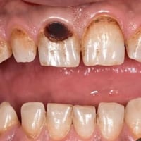 علاج مجاني • عيادات جامعه المشرق • عباس بن فرناس