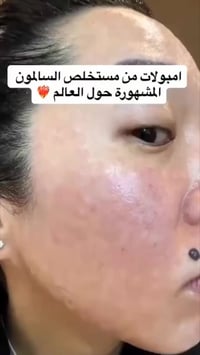 امبولات توهج • ميديكوب الوردية • ٩٩٪ مستخلص سلمون