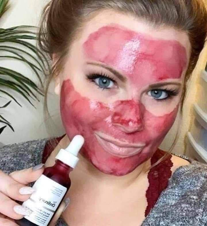 ‏THE ORDINARY Serum
‏AHA 30% + BHA 2% Peeling Solution 
سيروم مقشر للبشرة من ذا اوردنري الأمريكي 🇺🇸🇺🇸
✅ الفوائد الرئيسية 
✔️يعالج البقع والتصبغات ويحسن من مظهر البشرة وإشراقها.
✔️يناسب البشرة العادية ، المختلطة ، و البشرة الدهنية
✔️يعالج البقع ، الخطوط الدقيقة و التجاعيد ، البهتان و البشرة غير الموحدة
✔️يقوم بتقشير الطبقة العلوية للبشرة 
✔️ويساعد على تفتيح وتحسين مظهر بشرتك وتساعد احماض بيتا هيدروكسي على ازالة احتقان المسام 
✔️يحتوي مقشر الاحماض على فيتامين ب 5 الذي يساعد على علاج البشرة و نعومة البشرة.
يتميز هذا المقشر بفعاليته الملحوظة على تحسين البشرة وعلاجها .
#الاصلي المنشأ أمريكي 🇺🇸💯


**إذا كنت صاحب هذا الإعلان وتريد حذفه لأي سبب، رجاءا أرسل رسالة إلى الدعم الفني**