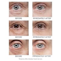 بيتر توماس روث • كريم عين • شدّ فوري