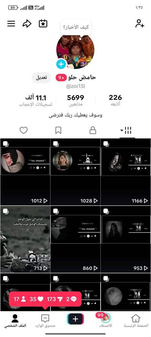 عراقي محتوى اغاني بث شغال حساب مرتب يرهم لجماعة امزون ويرهم شخصي حساب كلش حلو تفاعلة ومابي اي تقييد أو حظر حساب نظيف ربط نظيف وهذا رقمي *********** مكاني نجف وعندي ببعض المحافظات
