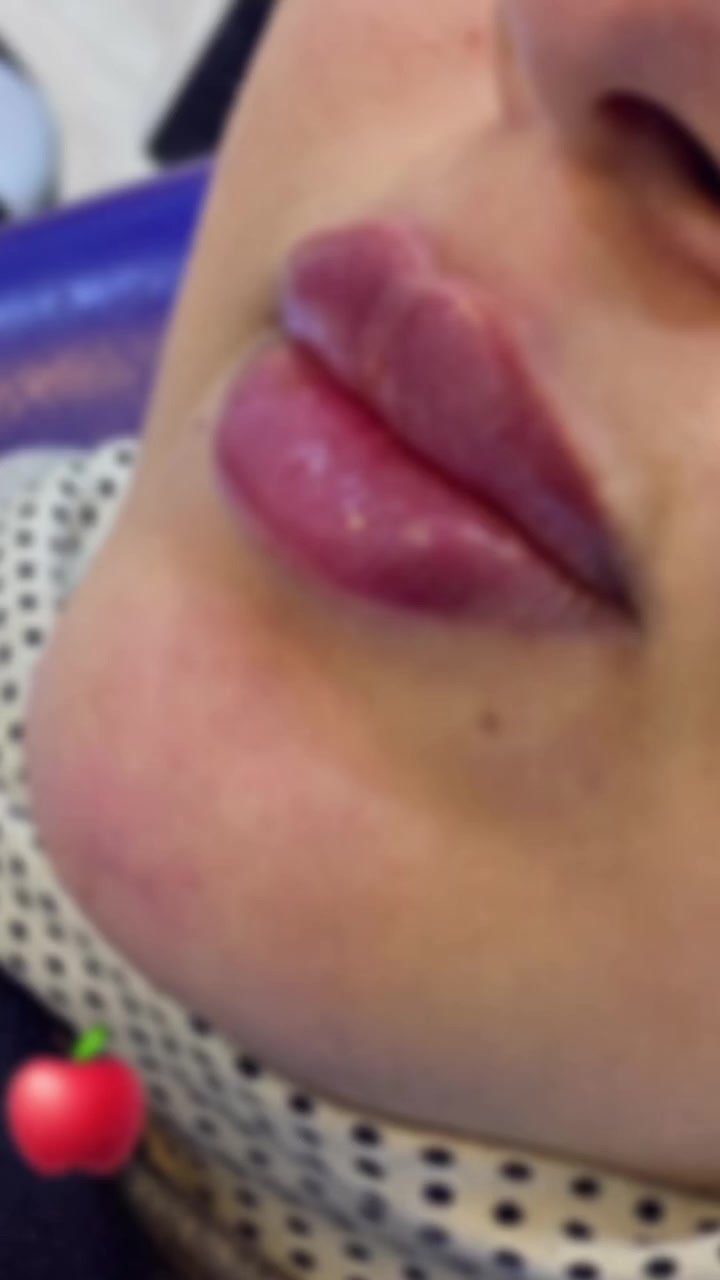 ليوم واحد فقط
تجدد عرض ٥٠٪؜على كل مواد الحقن داخل العياده 🍀❤️

الي ما لحگوا المره السابقه 

تكدرون تحجزون هسه 
العنوان/شارع دبي/مركز دار الشفاء الطبي 

للحجز والاستفسار 
***********

العدد محدود جدا ❤️
