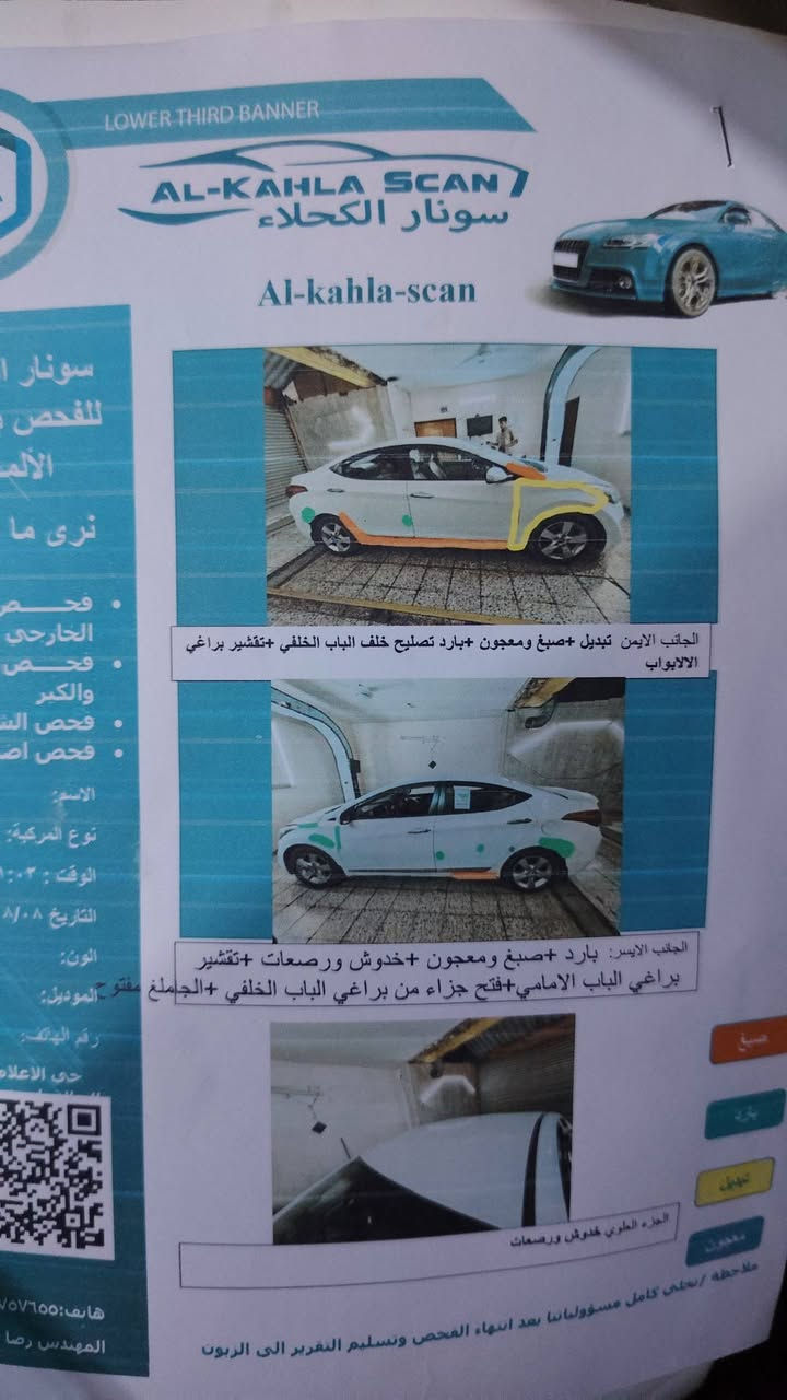 سلام عليكم الانتره خليجي مديل ١٣
سياره تحكم استيرن سياره نص فول  رقم بغداد مكينه كير مكفوالات مكينه الف 1600 دوش دغشن عالي اذا دغت دوانز رجعهه سياره بيهه بس جاملع امامي فقط تخم تاير جديد بيهه كهربايات كلهن شغاله اي نقص مابيهه ابد  سونار مرفق بل منشور سعر  (105 مكاني بغداد حي العامل واذ اكو مراوس كورله هايبرد اراوس ((( نضافتهه نفس بل فيديو


**إذا كنت صاحب هذا الإعلان وتريد حذفه لأي سبب، رجاءا أرسل رسالة إلى الدعم الفني**