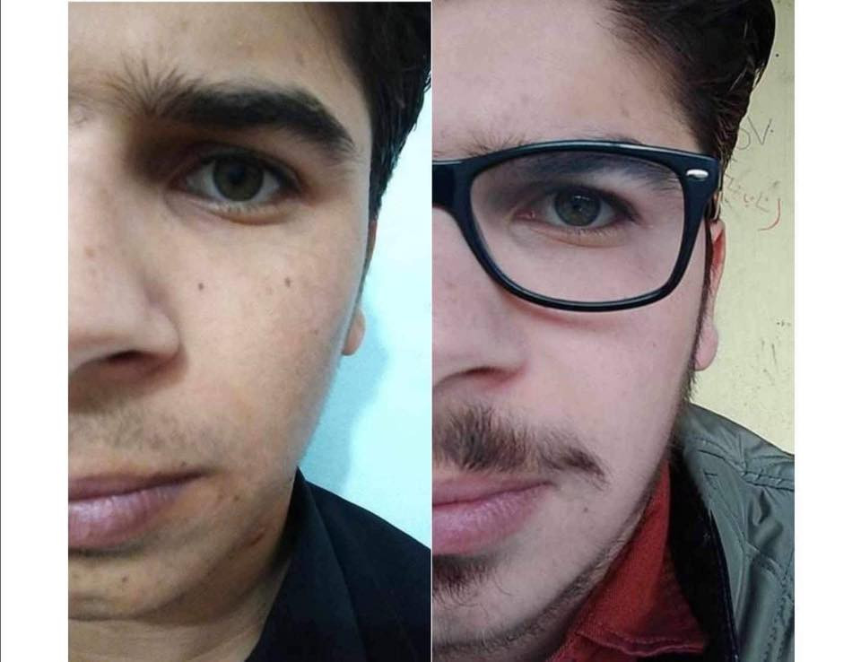 تۆش بەدەست کێشەکانی پێستەوە دەناڵێنی نازانی چی لێبکەیت و بەچی چارەسەری بکەیت🤔
کرێمێکت دەوێت بەگرەنتی👌 پارەگەڕانەوە ئەگەر سوودی نەبوو لەماوەی تەنها 🔺١٥ڕۆژدا
🟡سێتی کرێمی ئەمەریکی ئەڵلماس کەخاوەنی کوالێتی کۆنترۆڵە ☑️
ئەوەی ئەم کرێمەی بەکارهێناوە بۆهەمیشەیی ماڵئاوای لەتەواوی کێشەکانی ڕوخساری کردوە و دەوروبەری داوای ئەم کرێمەیان لێکردوە بەهۆی سوودو گۆڕانکاریە زۆرەکەیەوە 👍
ئەم کرێمە چارەسەری تەواوی ئەم کێشانەی ڕوخسارت بۆدەکات بەگرەنتیەوە 
🔺لابردنی زیپکەو شوێنەواری زیپکە
🔺لابردنیی پەڵەی سەرپێست و ژێرپێست
🔺لابردنی ڕەشی ژێرچاوو یەک ڕەنگ کردنی روخسار بەتەواوی
🔺لابردنی سوتاوی بەرخۆرو نەرم کردن و سافکردنی دەماوجاوو بەگشتی یەک ڕەنگردنی 
🟡کارتی گرەنتی و زەمانی بەکارهێنانی لەگەڵدایە سوودی تەواوت وەرنەگرت قەرەبوی تەواو دەکرێیتەوە 
بۆداواکردن و زانیاری زیاتر پەیوەندی بەم ژمارەیەوەبکەن
🚕گەیاندنمان بەردەستە 
📞***********
