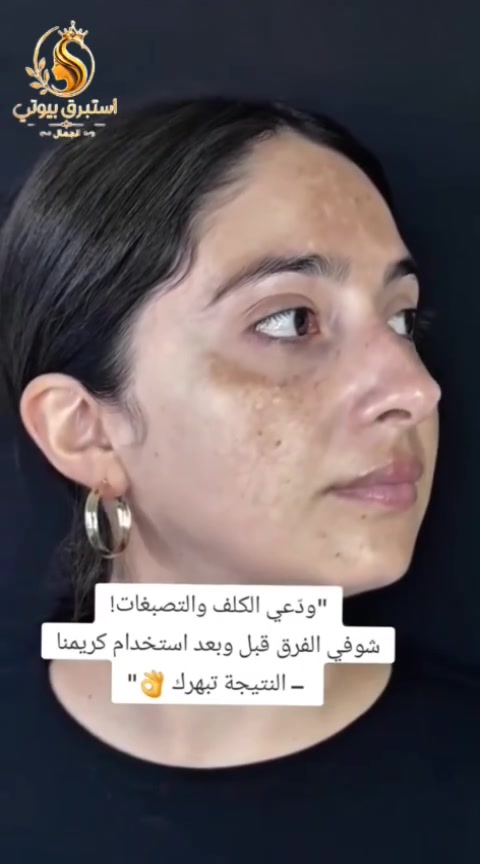 تألقي ببشرة مشرقة وحيوية كل يوم 
روتين العناية المتكامل يبدأ بلمسة تغذية عميقة تمنح بشرتج النعومة والنضارة التي تستحقها استمتعي بمظهر صحي وإشراقة طبيعية تدوم وتبرز جمالج الطبيعي
📬 للحجز أو الاستفسار خاص


**إذا كنت صاحب هذا الإعلان وتريد حذفه لأي سبب، رجاءا أرسل رسالة إلى الدعم الفني**